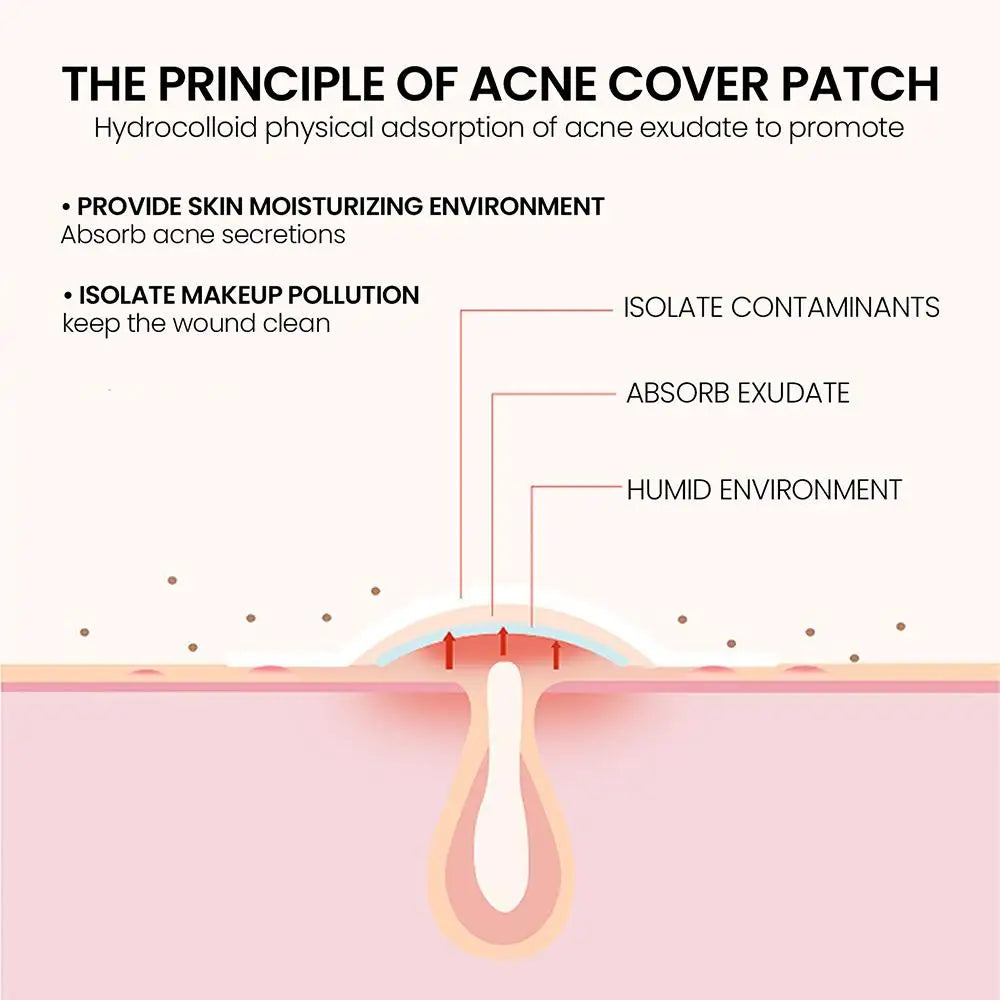 200pcs Star Pimple Patch Acne Invisible Acne Removal Stickers Originality Concealer Face Spot Beauty Skin Care Makeup Tools