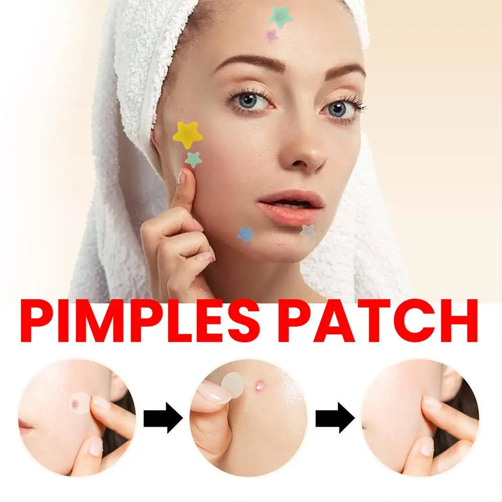 200pcs Star Pimple Patch Acne Invisible Acne Removal Stickers Originality Concealer Face Spot Beauty Skin Care Makeup Tools